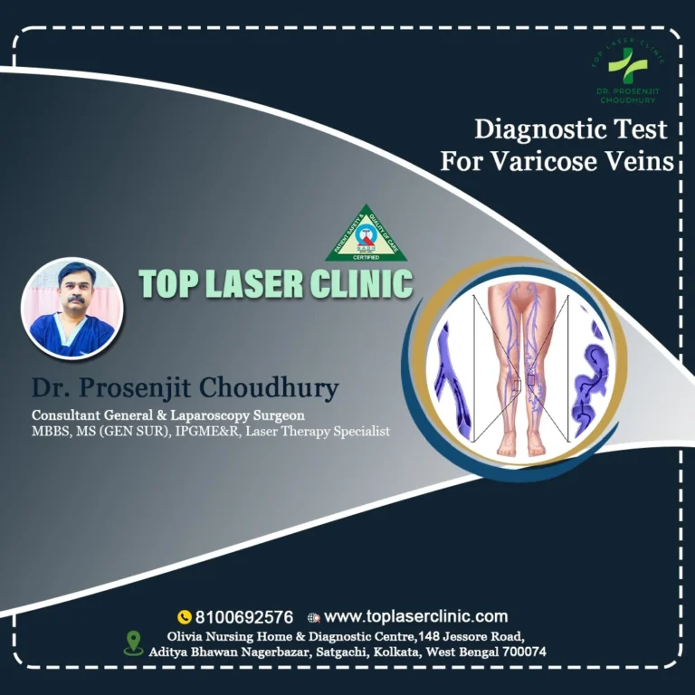 4 Diagnostic test for varicose veins