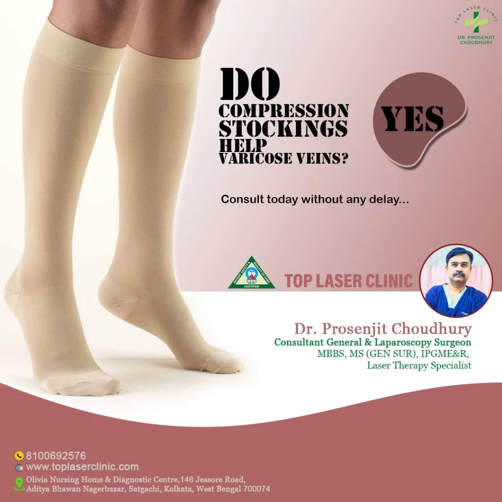 Do compression stockings help varicose veins problems by 4 different ways