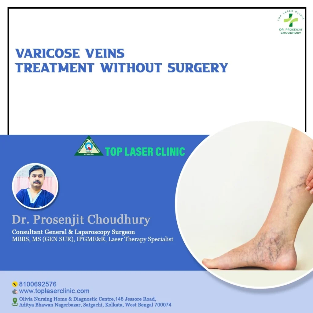 3 types of Varicose veins treatment without Surgery
