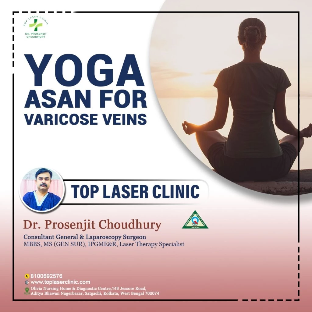 Yoga Therapy for Varicose Veins | Andiappan Yoga