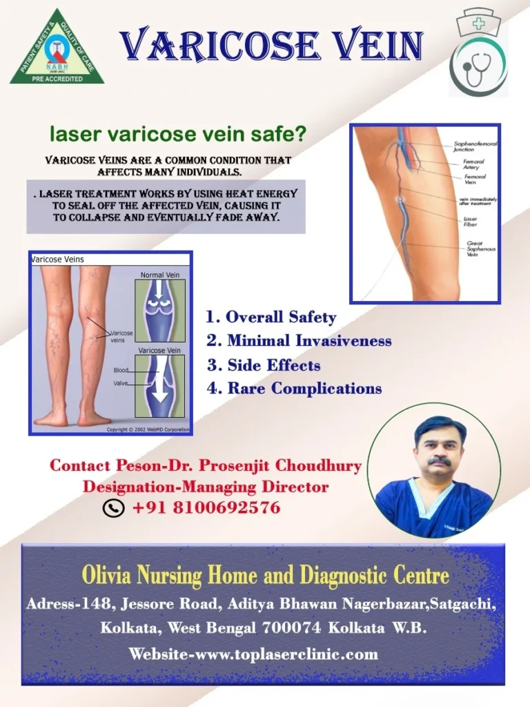 Is laser varicose vein safe?