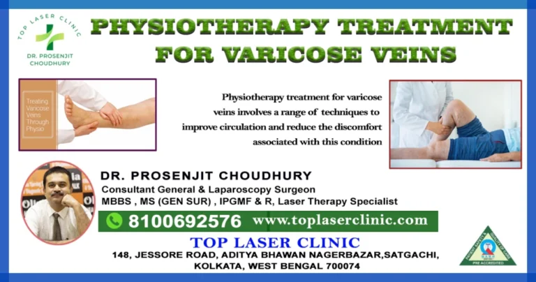 Physiotherapy treatment for varicose veins :