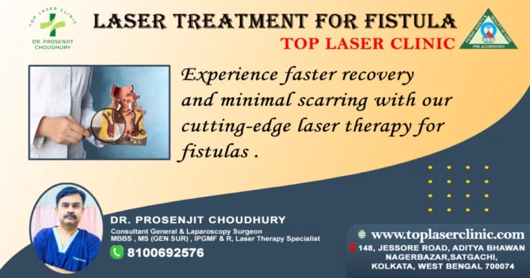 Laser treatment for fistula