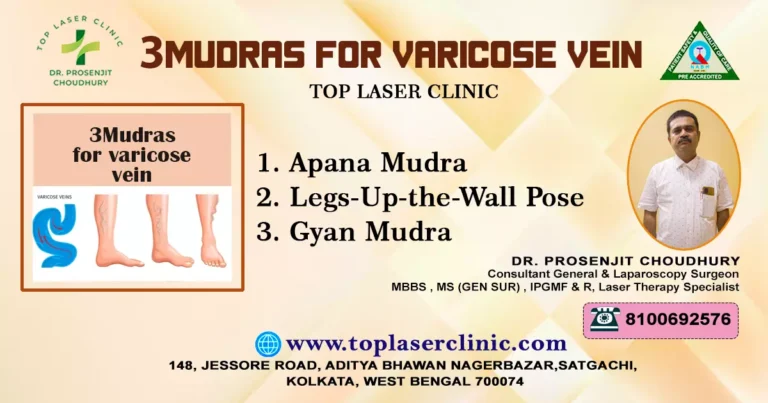 3 Mudras for Varicose Vein