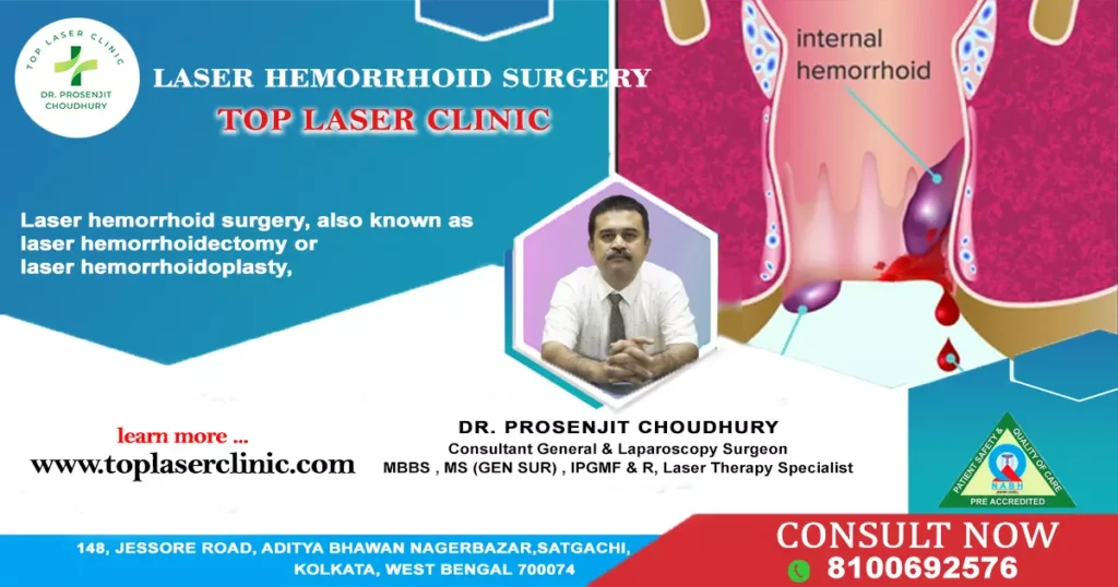 Pros and cons of laser hemorrhoid surgery