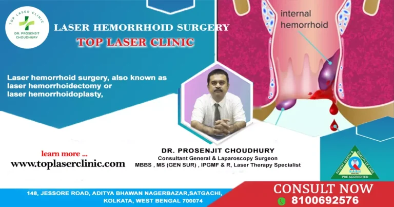 5 Pros and 5 cons of laser hemorrhoid surgery