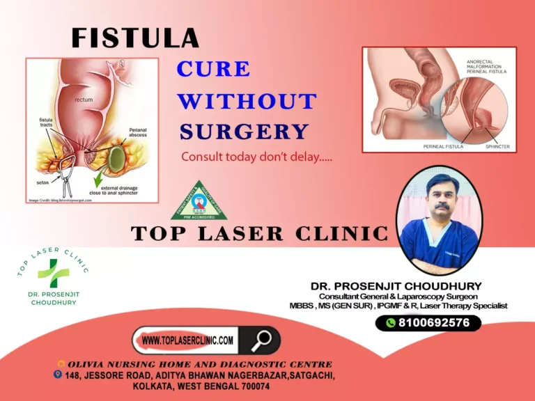 Fistula cure without surgery