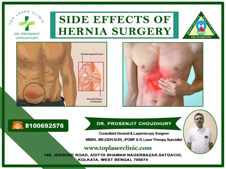 7 Long term side effects of hernia surgery