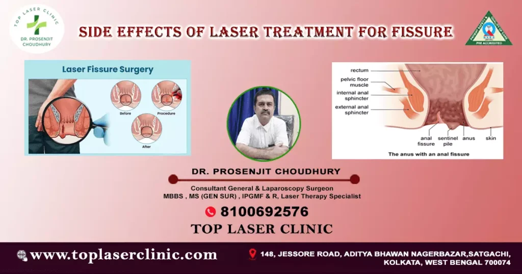 Side-effects-of-laser-treatment-for-fissure-in-closing