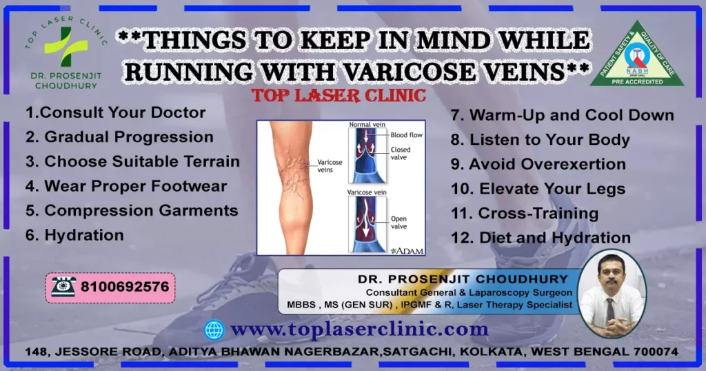 running-make-varicose-veins-worse-things to-keep-in-mind
