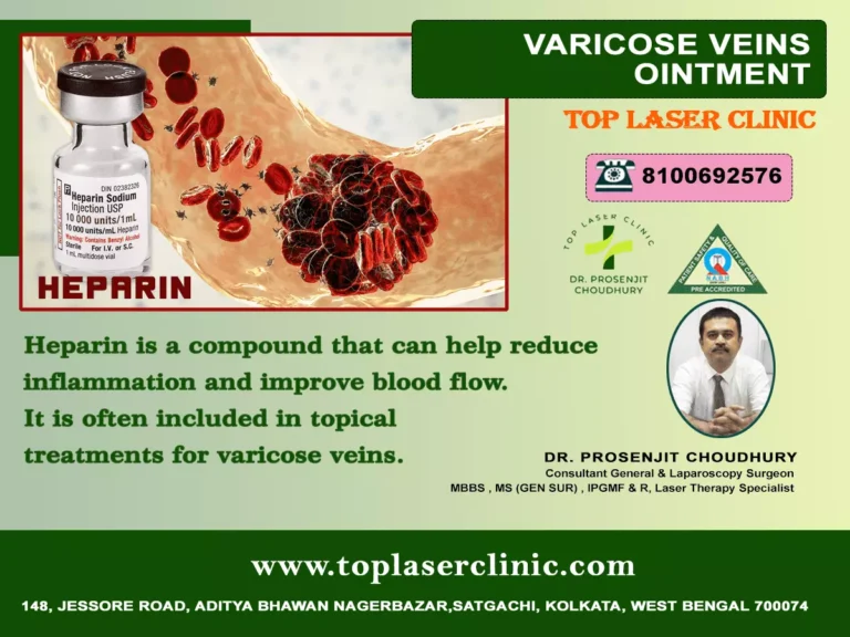 Varicose vein ointment