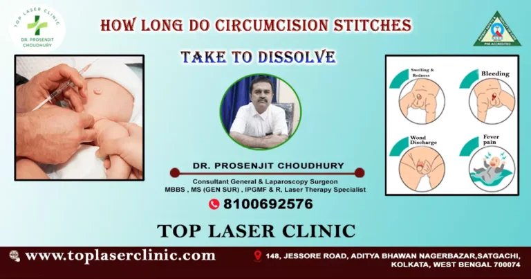 How long do circumcision stitches take to dissolve