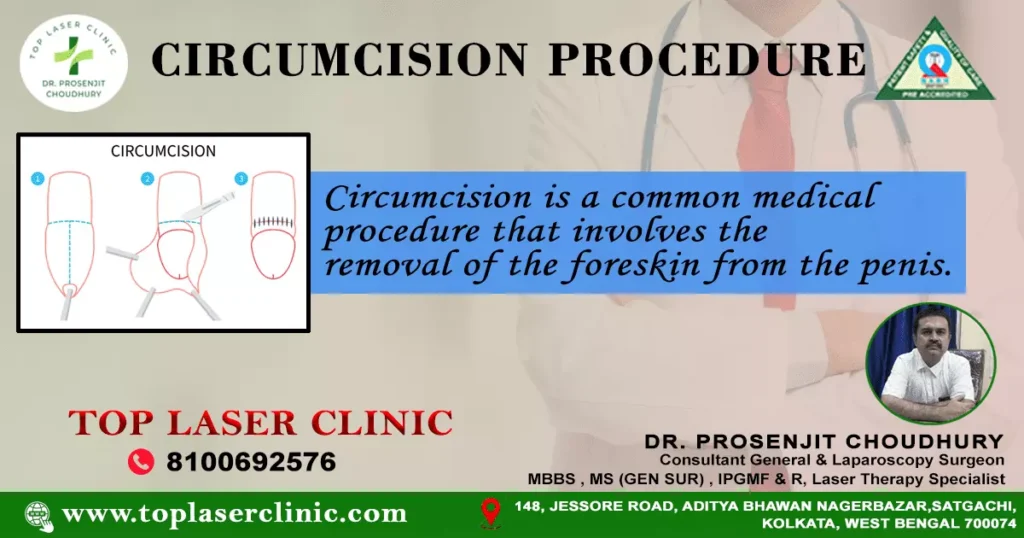 How-long-do-circumcision-stitches-take-to-dissolve