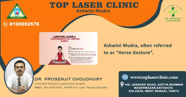 Healing Hemorrhoids Naturally with Ashwini Mudra: A Holistic Approach