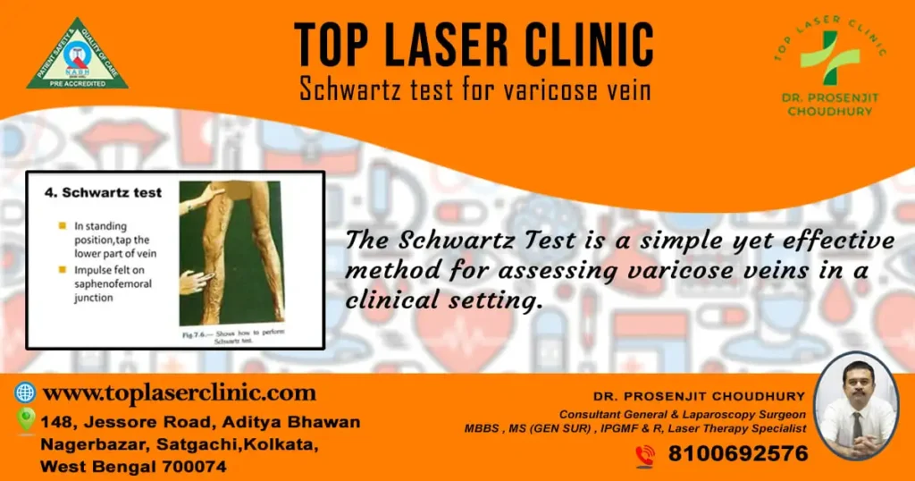 varicose-vein-examination-method-schwartz-test