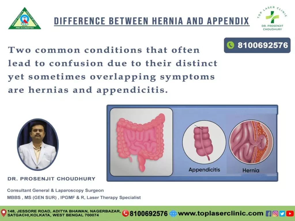 Hernia-vs.-Appendicitis