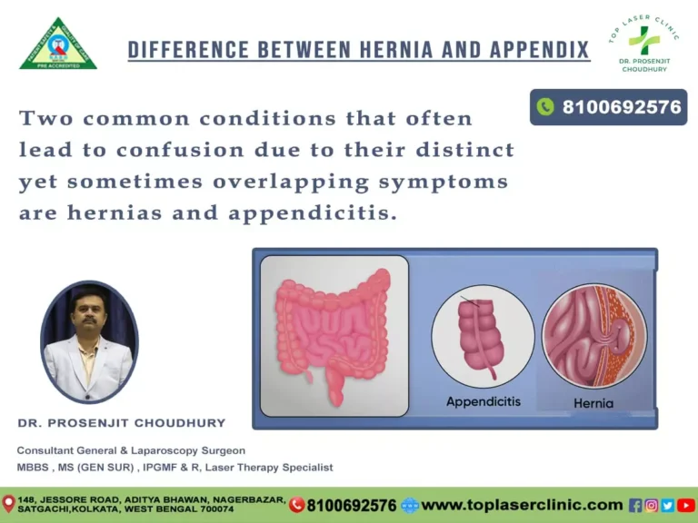 Understanding the Variances: Hernia vs. Appendicitis – Deciphering Abdominal Puzzles