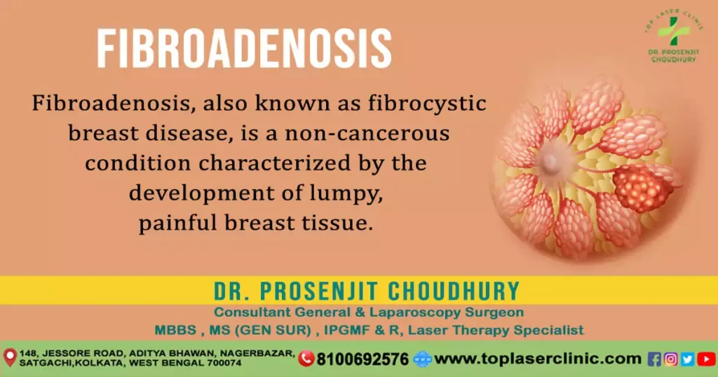 Fibroadenosis-and-Fibroadenoma