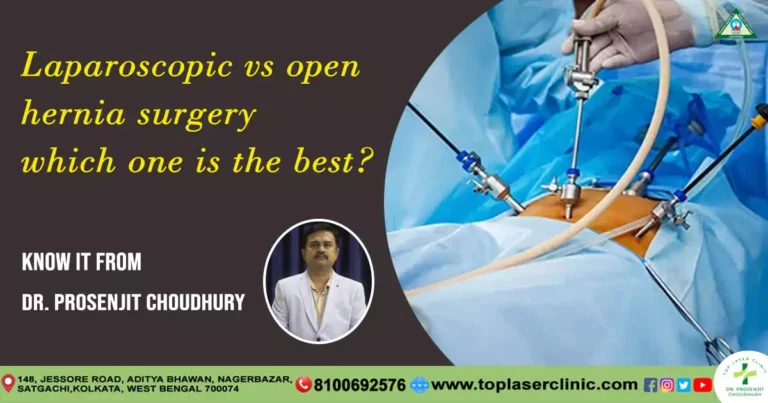 Exploring the Differences: Laparoscopic and Open Surgery for Hernia Repair