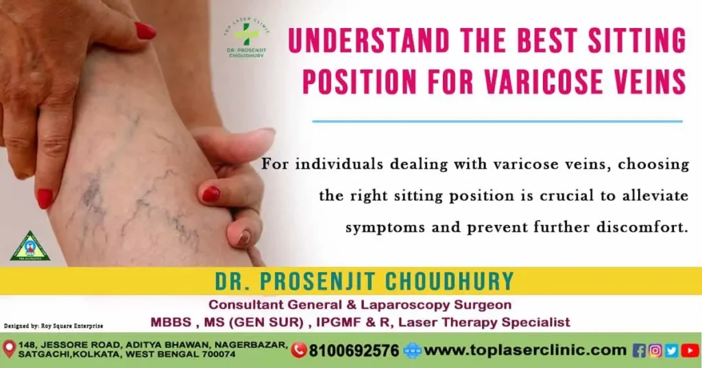best-sitting-position-for-varicose-veins