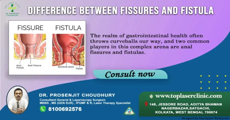 Clarifying Fissures and Fistulas: Unveiling the Divide, Understanding the Journey to Recovery