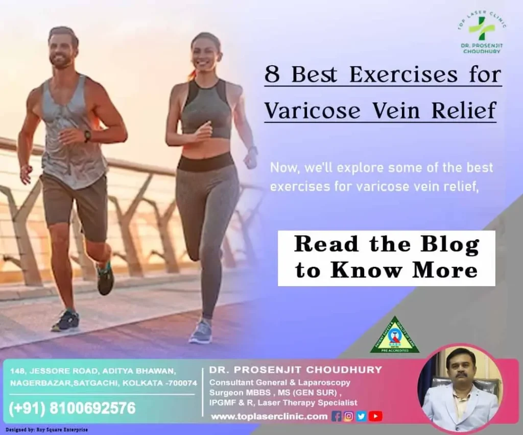 exercises-for-varicose-vein-relief