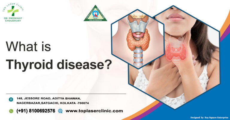 Thyroid Disease: A Common Disease Of These Days