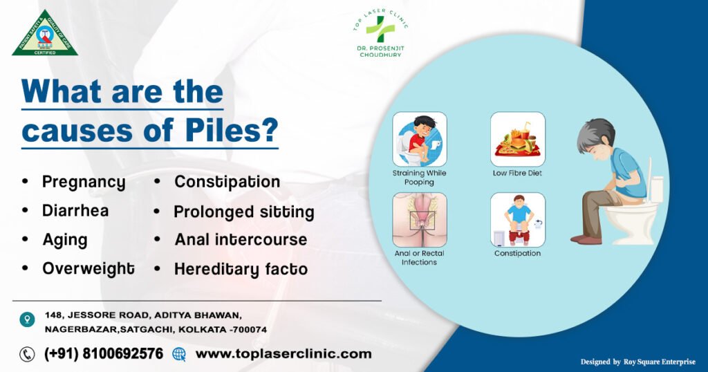 What Are Piles Symptoms Causes Effective Treatments