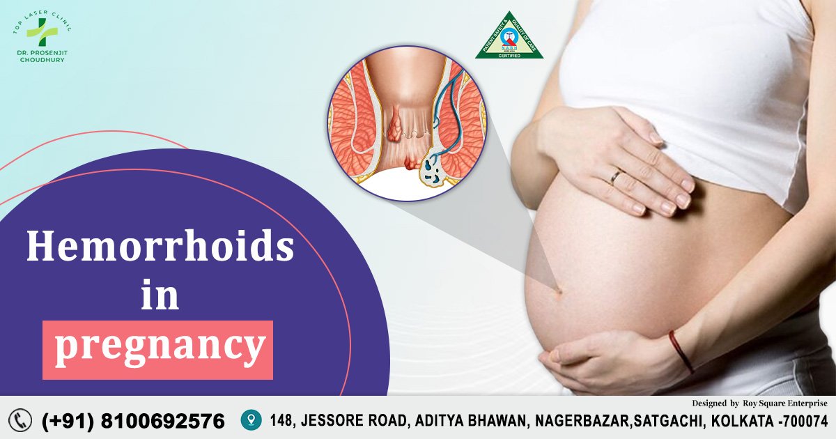 Hemorrhoids in Pregnancy survival guide: Symptoms, Causes & Surgical ... - Risks Of Ice Packs For Hemorrhoids During Pregnancy