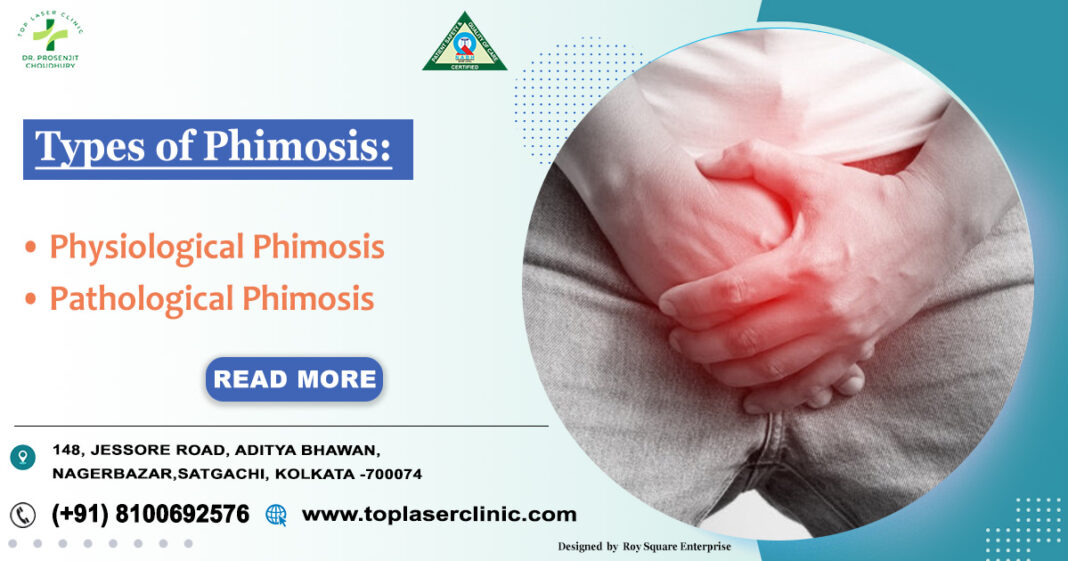 Understanding Phimosis Description Symptoms Types Causes Treatment