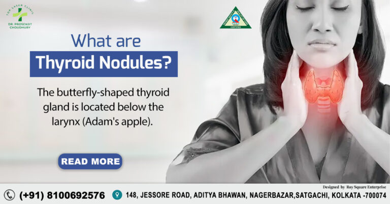 Thyroid Nodules: Causes, Signs & Expert Treatment Options