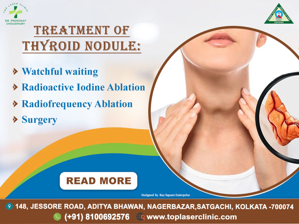 Thyroid Nodules