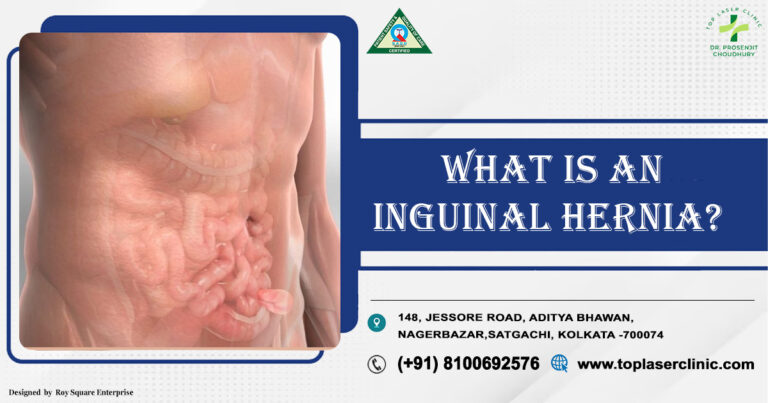 Inguinal Hernia: Expand Your Knowledge with Key Insights