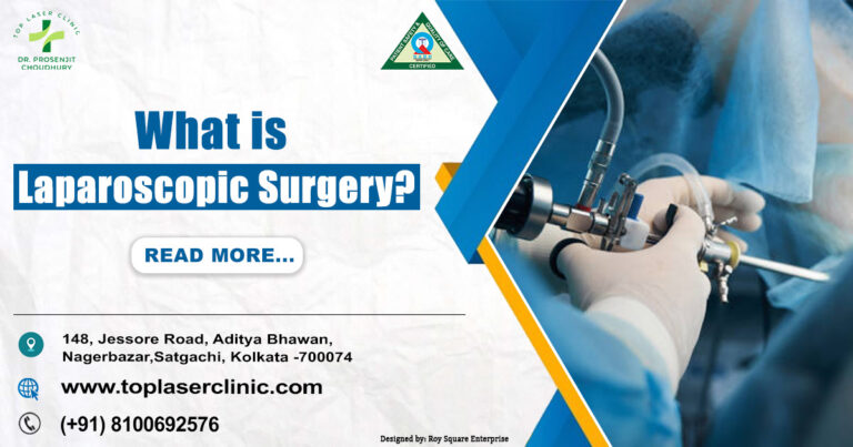 Laparoscopic Surgery: Advanced Method & Fast Recovery