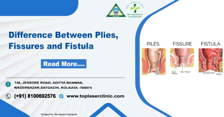 Difference Between Piles, Fissures and Fistula