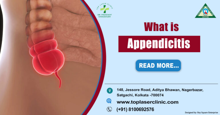 Appendicitis: Treatment Options Available