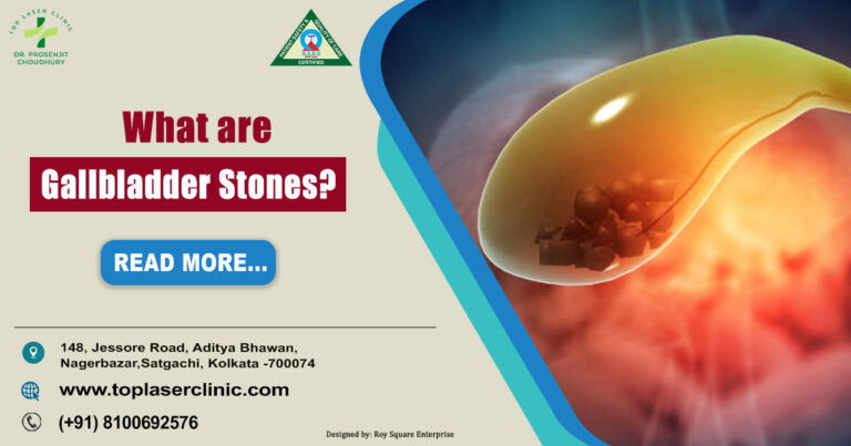 Gallbladder Stones: Common Signs & Symptoms