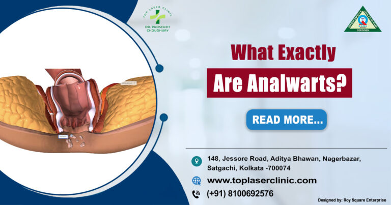 Anal Warts: Symptoms, Causes & Treatment Guide