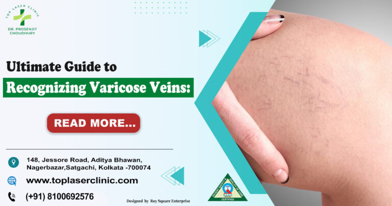 Ultimate Guide to Recognizing Varicose Veins: 7 Powerful Insights on Causes, Diagnosis & Recovery