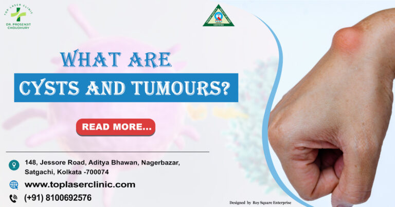 10 Clear Signs to Distinguish a Cyst from a Tumour | Trusted Advice by Dr. Prosenjit Choudhury
