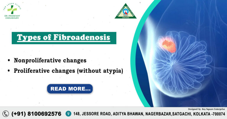 Fibroadenosis vs. Fibroadenoma: 7 Expert Insights You Need to Know for Better Breast Care