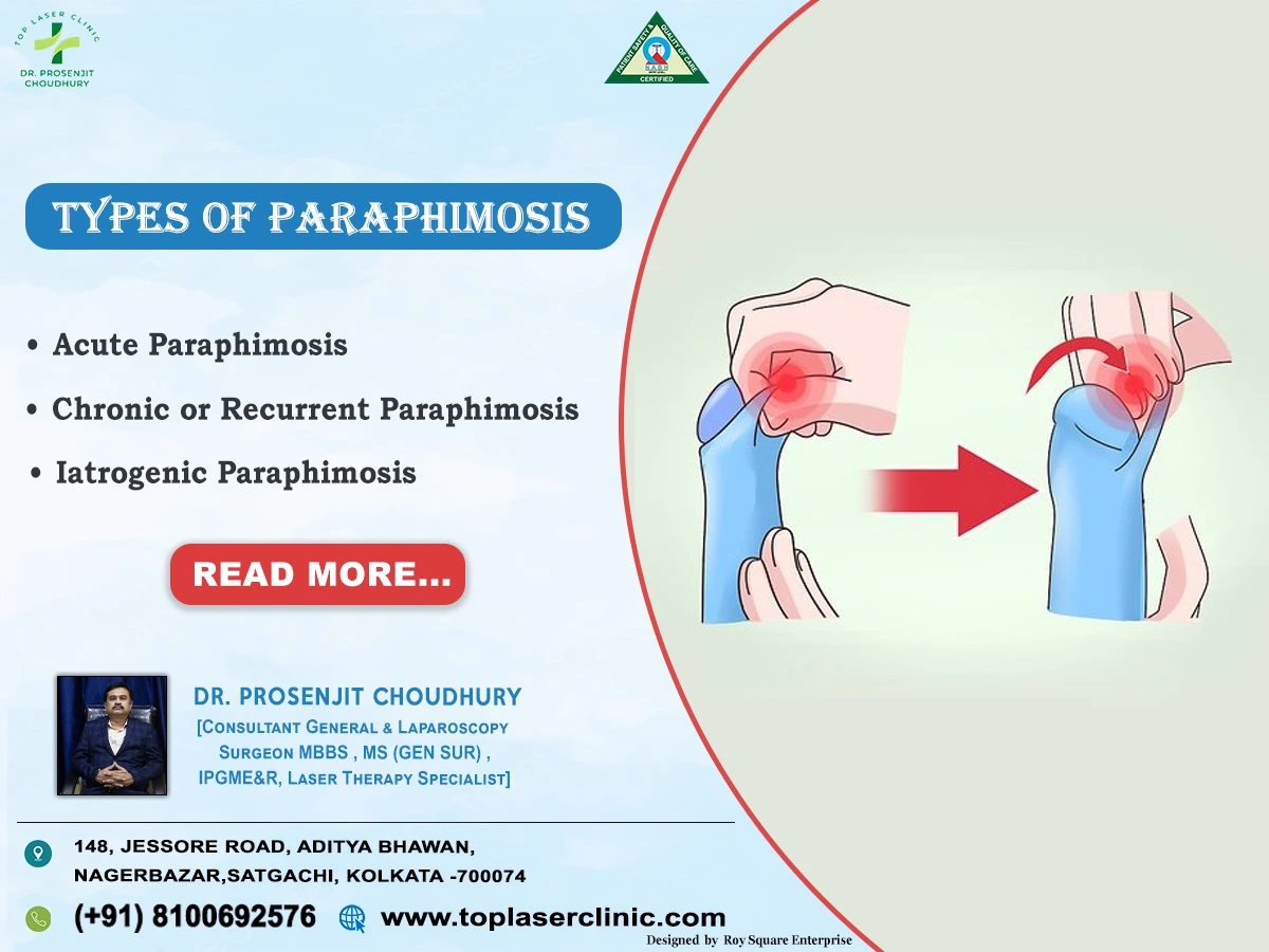 Types of Paraphimosis
