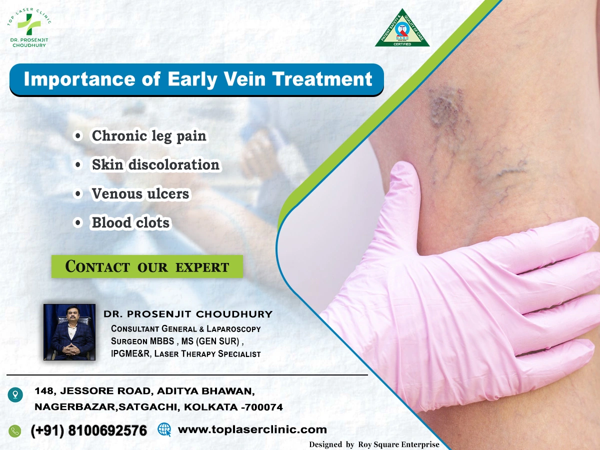 Importance of Early Vein Treatment