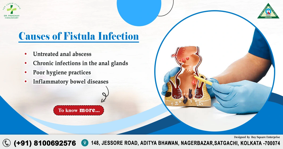 Causes of Fistula Infection