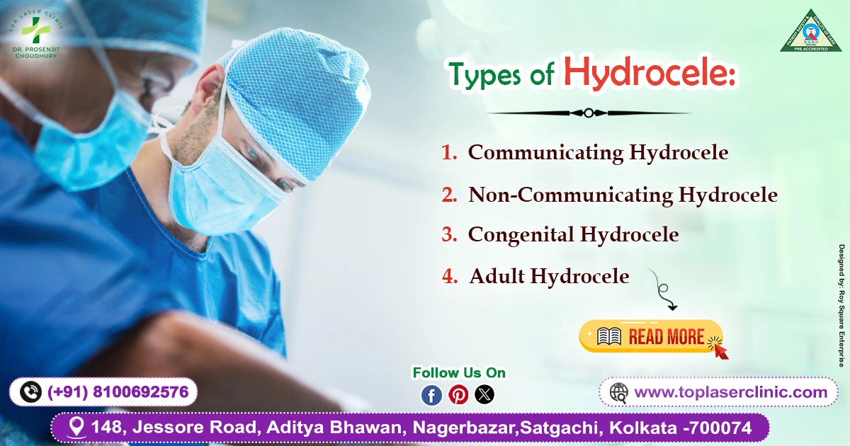 Types of Hydrocele