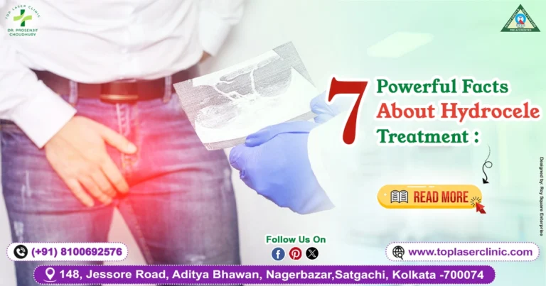7 Powerful Facts About Hydrocele Treatment: Symptoms, Surgery & Recovery Guide