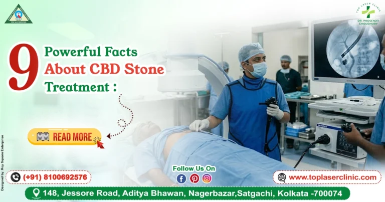 9 Powerful Facts About CBD Stone Treatment: Symptoms, Surgery & Recovery Guide