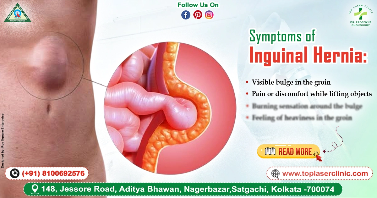 Symptoms of Inguinal Hernia