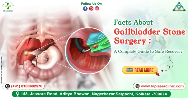 Facts About Gallbladder Stone Surgery: A Complete Guide to Safe Recovery