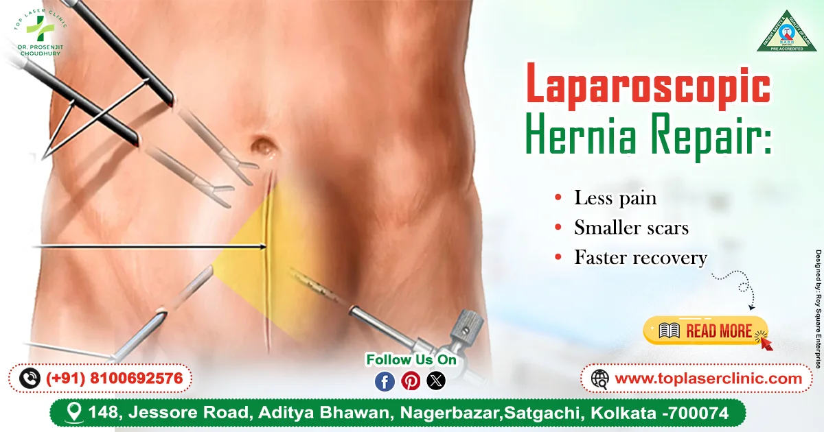 Laparoscopic Hernia Repair